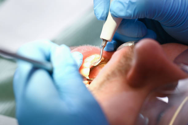 Best Emergency Broken Tooth Repair in Day Valley, CA