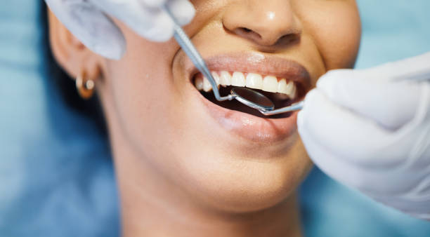 Best Emergency Tooth Extraction in Day Valley, CA