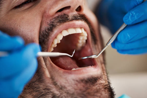 Best Walk-In Emergency Dentist in Day Valley, CA